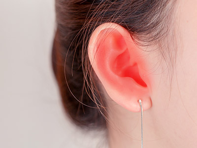 中耳炎怎么治疗 中耳炎的症状