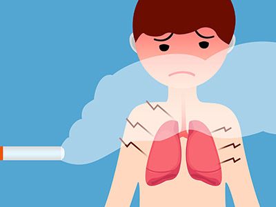 肺炎怎么治疗 肺炎的症状表现